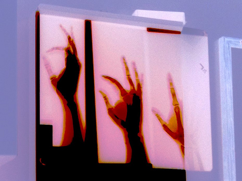 Hand x-rays
